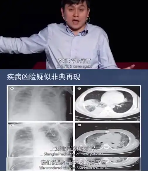  八一八最近非常火的张文宏医生,一个平平无奇的抗疫小天才