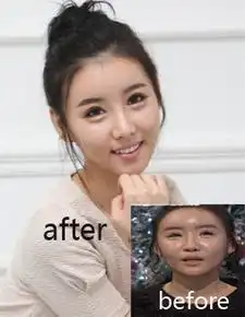  韩国整形中毒女从假人又整回真人