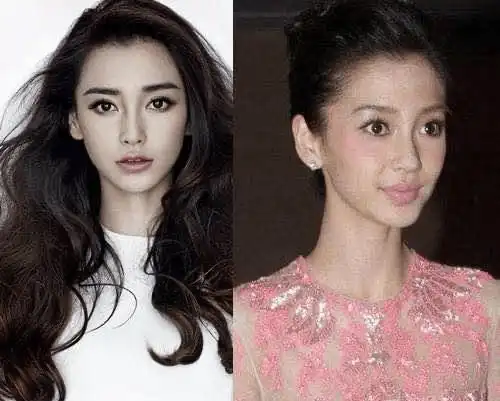  那些经常做医美的人,皮肤真的变好了吗王鸥后悔都晚了