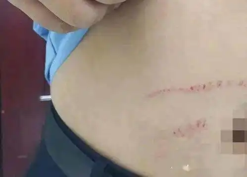  刑拘济南一女子坐公交拒按要求戴口罩,还多次袭警