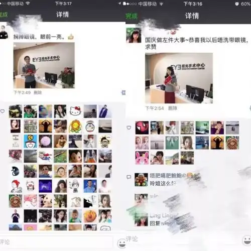  佛山全飞秒近视手术,最好的夫妻关系是共同摘镜一起改变