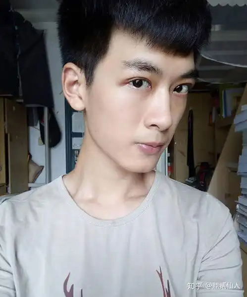  男生做双眼皮手术是什么体验