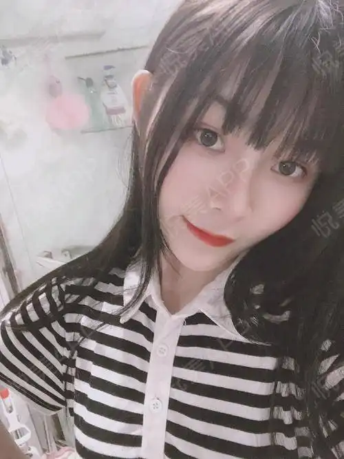  好久不见小姐妹们,我又来啦这两天休息在家抖音刷多...隆鼻悦美整形