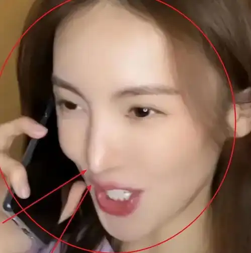 上镜垮就少演正剧演员一出场,观众才看清整容脸有多离谱