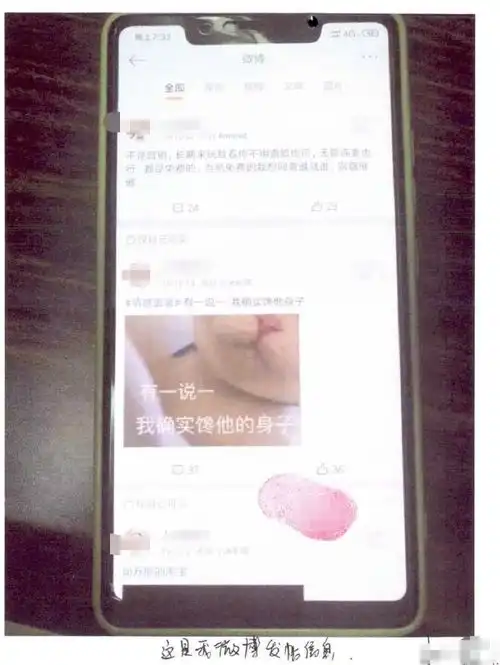 引流管引流管最新消息,新闻,图片,视频聚合阅读新浪网
