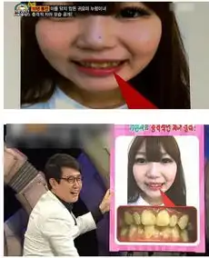 真人头像女生整容