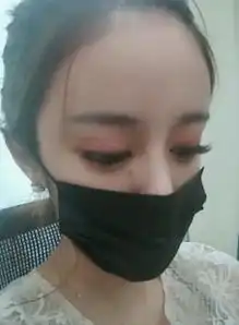  抖音小姐姐花300万整容,哭诉下巴整坏了,摘下口罩都说美爆了